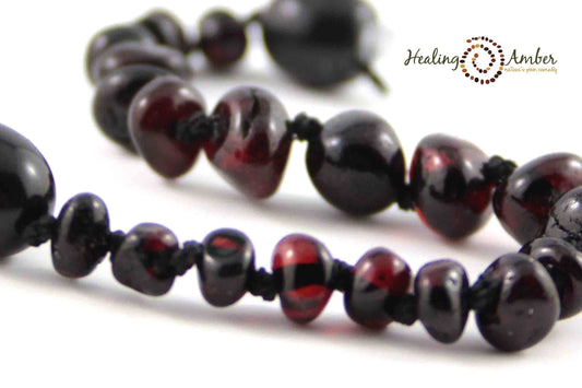 Baltic Amber Necklace - Molasses Circle 13"